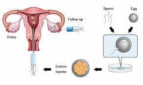 IVF - Frozen Embryo Transfer Auspicious Date and Time by Astrology